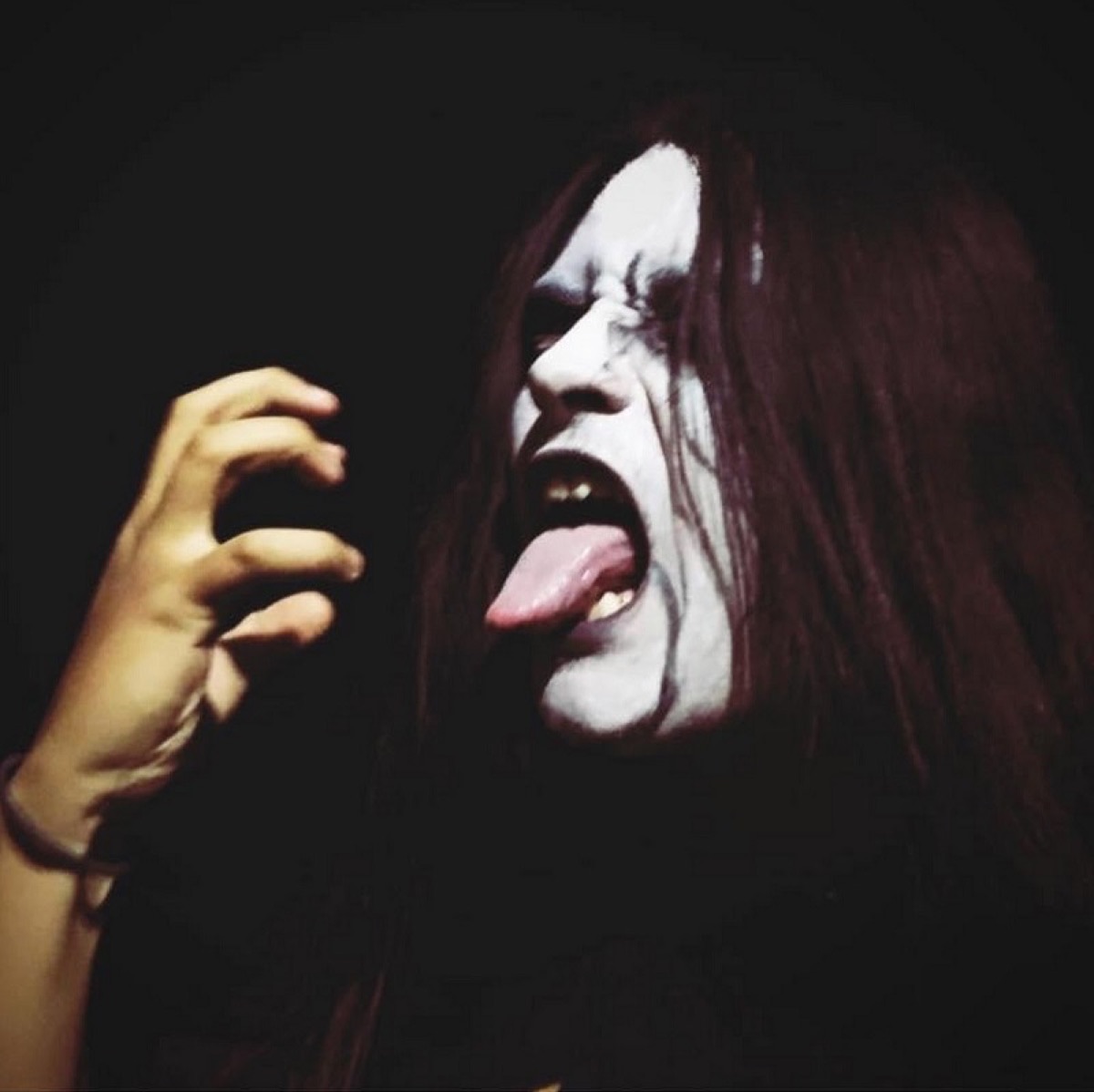 Disengorgement
